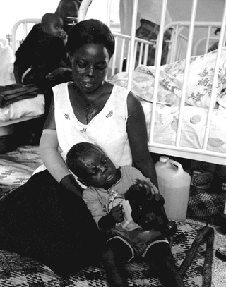 Uganda, 103-012-10 Una donna e un bambino con cicatrici in volto siedono ai piedi di un letto d'ospedale, 2008 Ospedale Mulago, Kampala (Uganda)