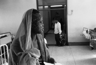 Uganda, 103-007-30 Una donna con cicatrici da ustione in volto, 2008 Ospedale Mulago, Kampala (Uganda)