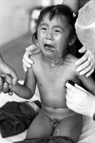 Cina, 102-047-35
Bambino piange mentre viene esaminato, 2007
Ospedale Civile, Siyang (Cina)