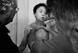 Cina, 102-043-26
Medici controllano le cicatrici da ustione su un paziente, 2007
Ospedale Civile, Siyang (Cina)