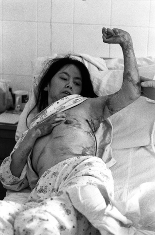 Cina, 102-036-10
Una donna viene controllata a letto, 2007
Ospedale Civile, Siyang (Cina)