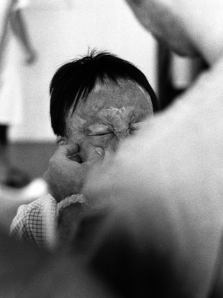 Cina, 102-034-05
Un medico controlla il volto di un bambino, 2007
Ospedale Civile, Siyang (Cina)