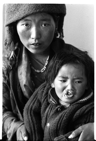 Tibet, 102-012-28 Una donna e il figlio con labbro leporino, 2004 Shigatse (Tibet)