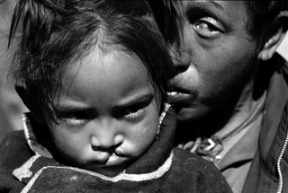 Tibet, 102-010-02 Bambina con labbro leporino in braccio a un uomo, 2004 Shigatse (Tibet)