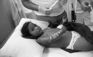 Bolivia, 104-007-36
Bambina con ustioni e braccio amputato su un letto, 2010
Ospedale Municipale, Camiri (Bolivia)