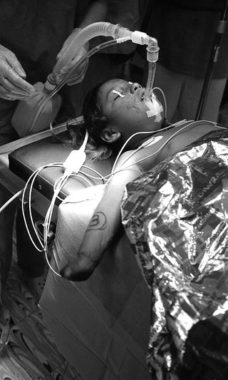 Bolivia, 104-007-12
Bambina con amputazione sottoposta a un intervento, 2010
Ospedale Municipale, Camiri (Bolivia)